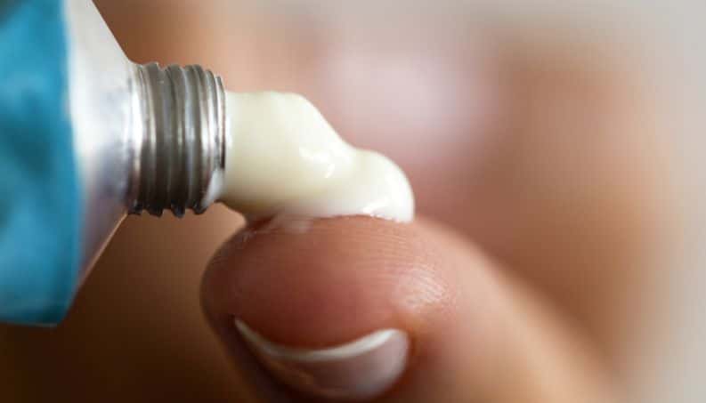 Guia completo sobre melasma: causas