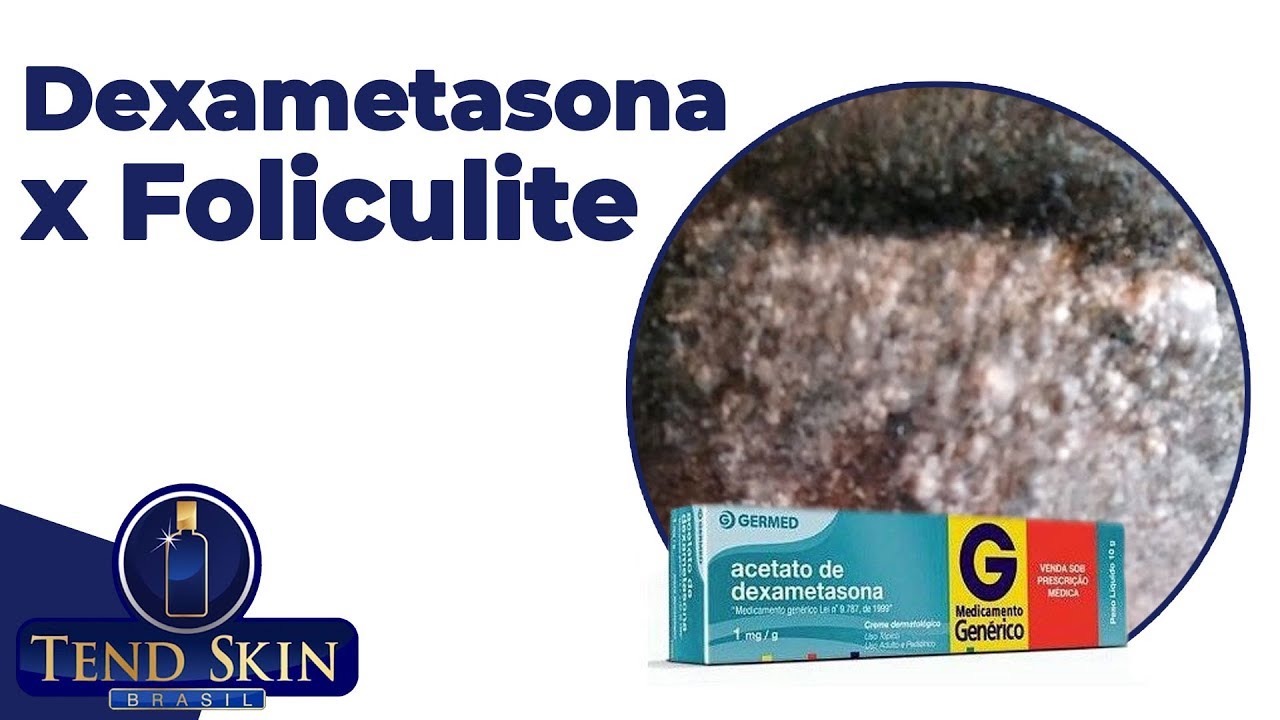 Acetato De Dexametasona Serve Para Clarear A Pele