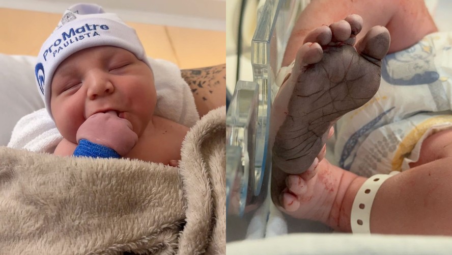 Bebê Mais Forte Do Mundo Impressiona Ao Ficar Em Pé