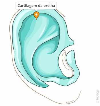 riscos de furar a cartilagem