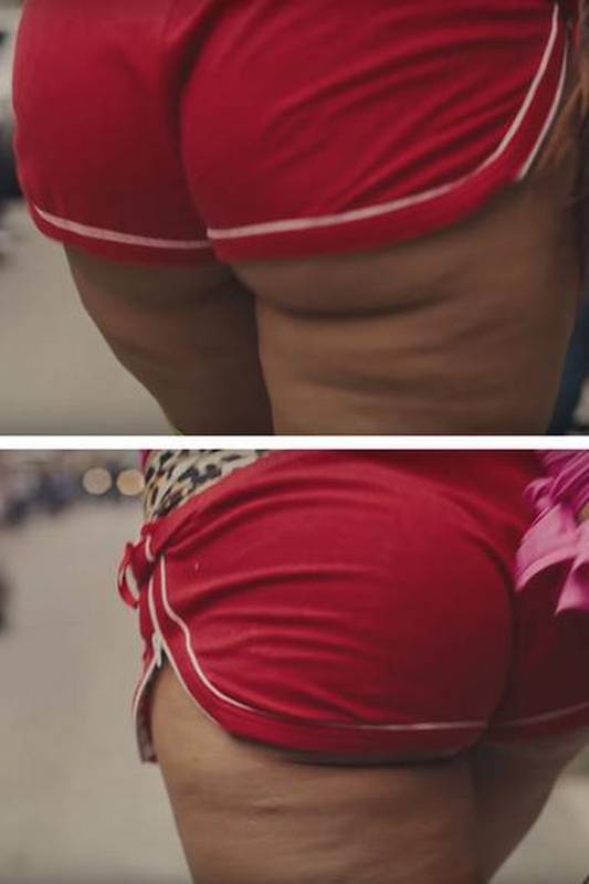 Fotos Da Anitta Com Celulite