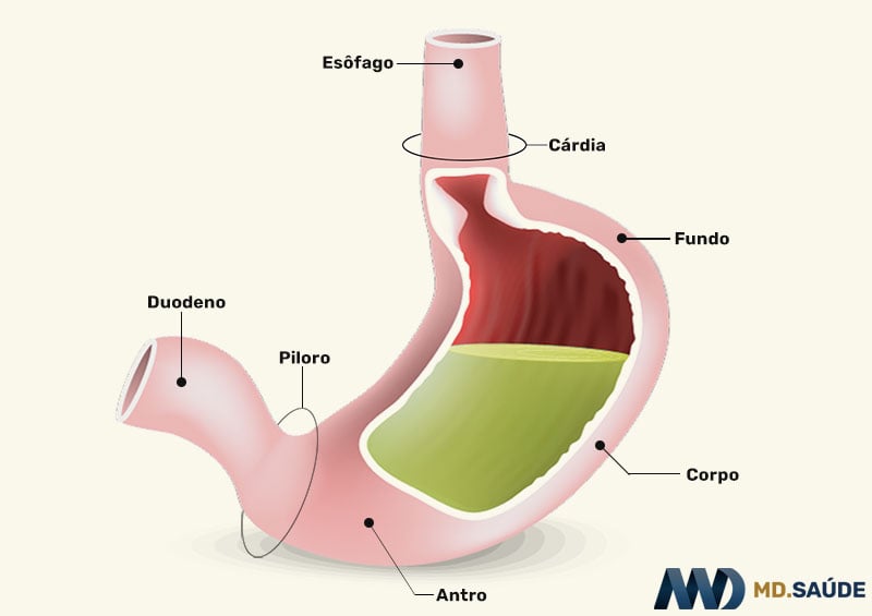 Gastrite Enantematosa Leve: Sintomas