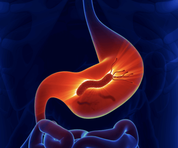 Tratamento da Gastrite Enantematosa: Medicamentos e Mudanças de Estilo de Vida