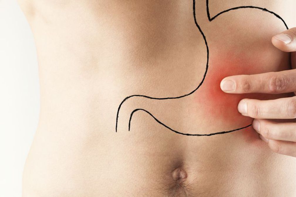 Diferenças entre Gastrite Antral e Pangastrite Enantematosa: O que Você Precisa Saber
