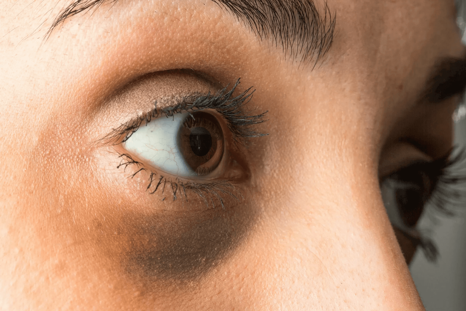 creme para bolsas nos olhos