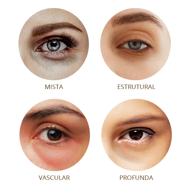 creme para bolsas nos olhos