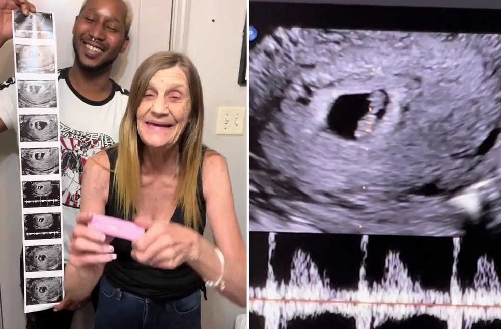 Primeira Gravidez Aos 37 Anos