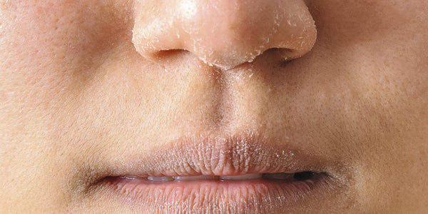 Skincare para Pele Seca: Montando sua Rotina Ideal Passo a Passo