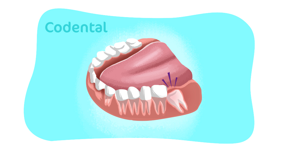 dente do juízo nascendo