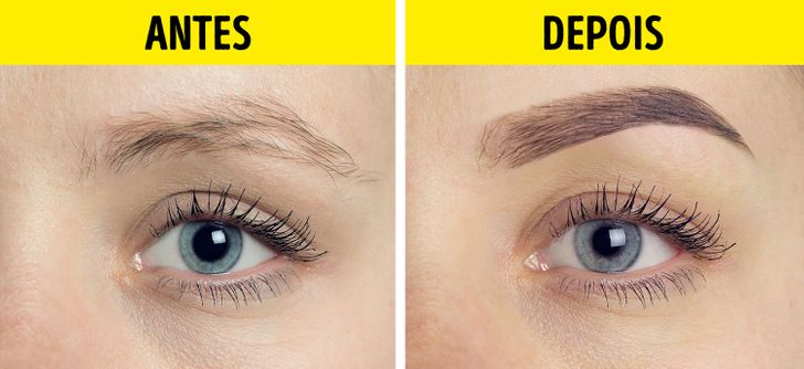 Cuidados Essenciais Após o Laser nas Sobrancelhas