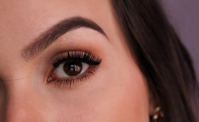 Depilação a Laser na Área da Sobrancelha: Mitos e Verdades