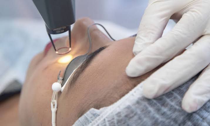 bioestimuladores de colágeno preço