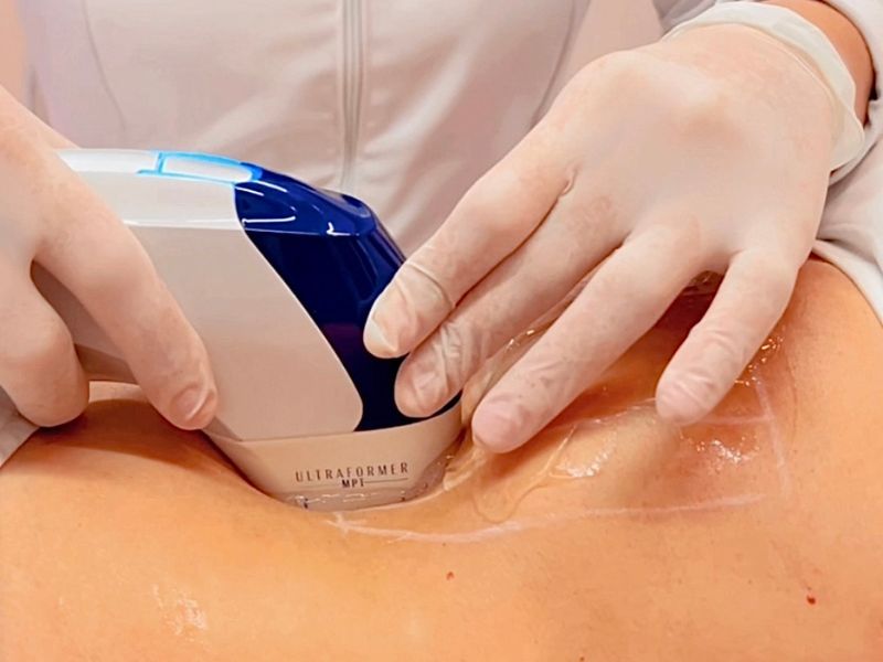 sustentação e firmeza da pele