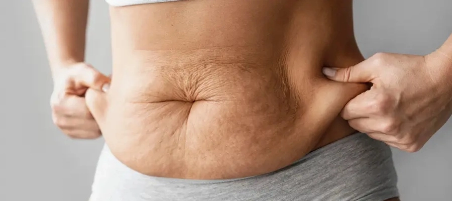 bioestimuladores de colágeno preço